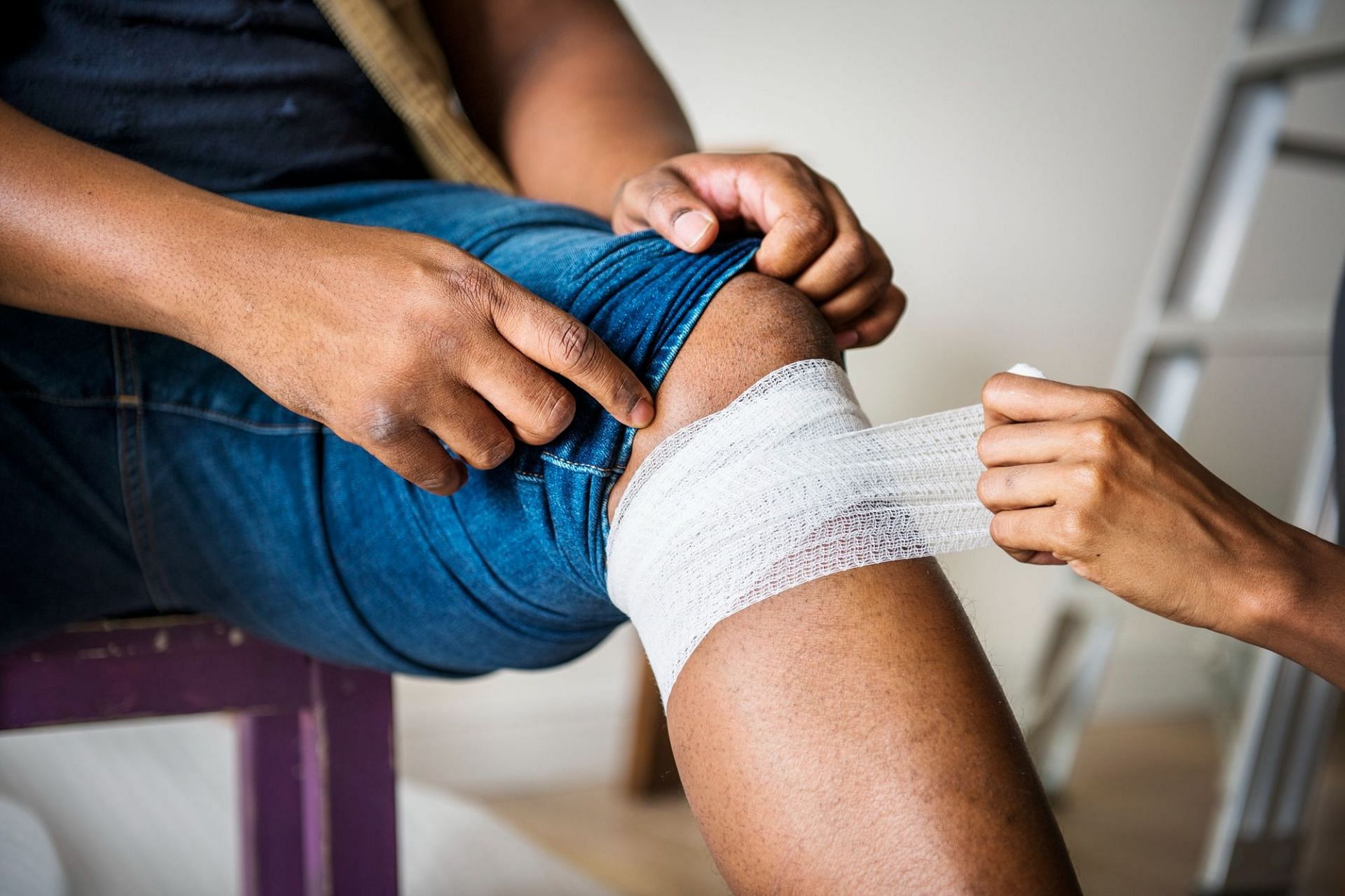 Home remedies for bruises (Image via Freepik)